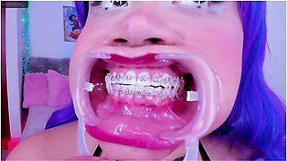 Lila Jordan, Suspenders, Braces