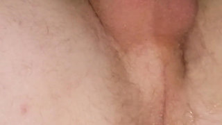 Dominatrix Causes Extreme Rosebud and Fat Ass Lips
