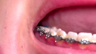 Brace Faced Teen Amira Mae Rough Throat Fucking & Ass Eating
